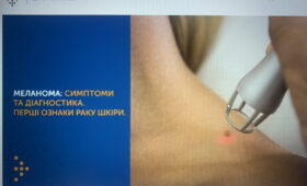 МЕЛАНОМА: СИМПТОМИ, ДІАГНОСТИКА ТА ПРОФІЛАКТИКА