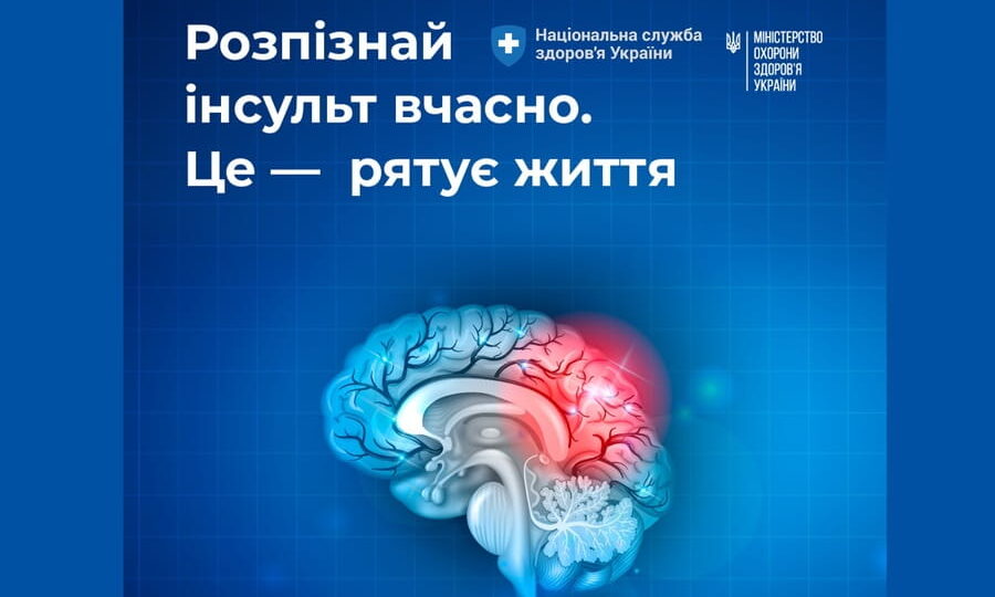 Яка медична допомога гарантована внутрішньо переміщеним особам при інсульті