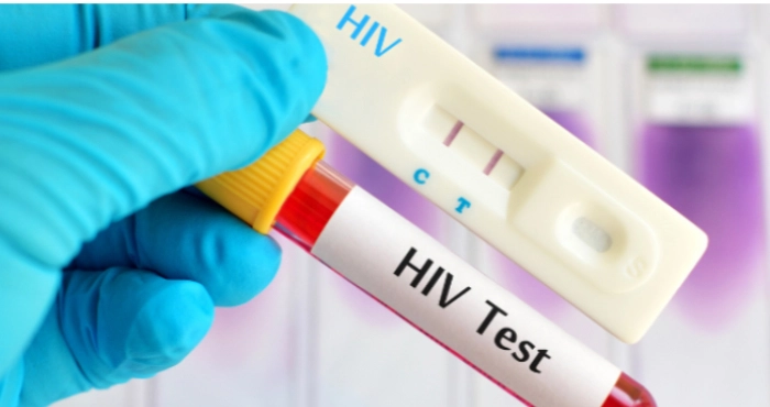 Місячник тестування на ВІЛ триває!